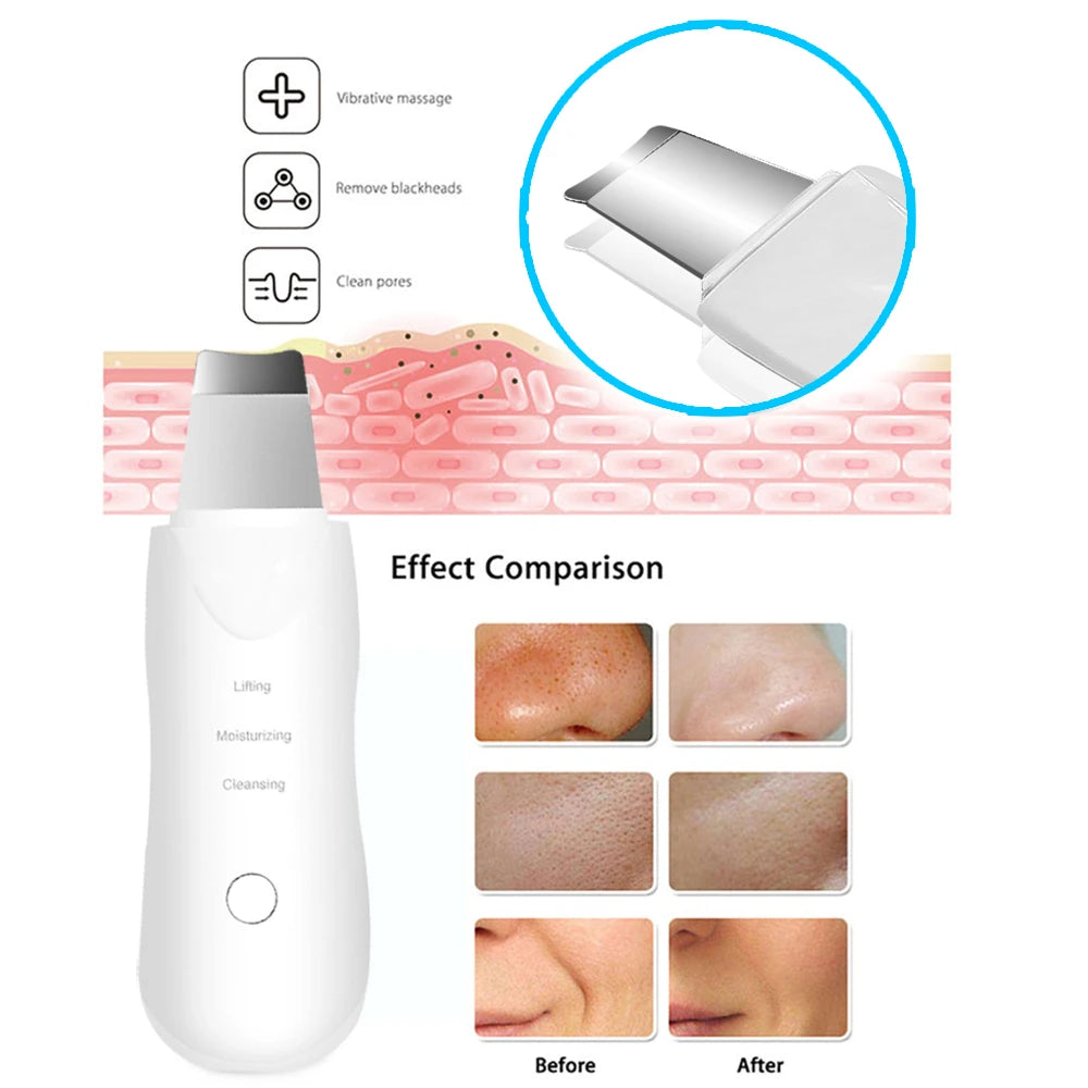 AquaLift Skin Scrubber