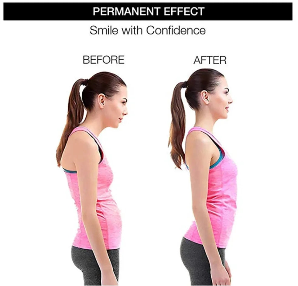 ErgoPosture Corrector
