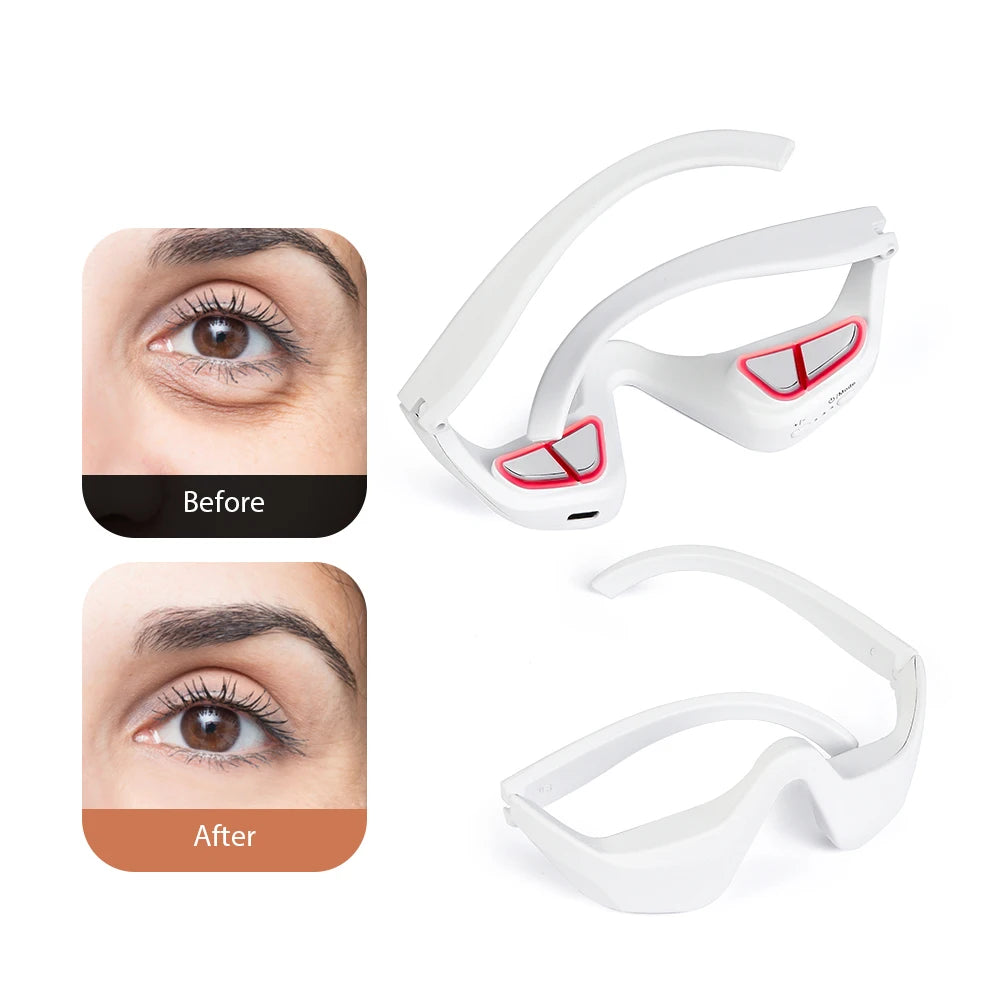 SparkleGaze Eye Massager